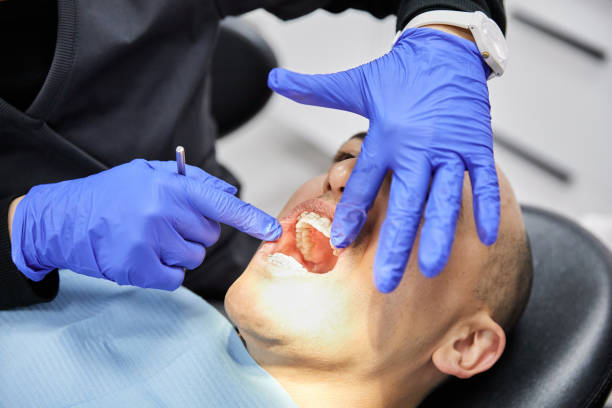 Best Lost Filling or Crown Replacement in Ridgewood, IL